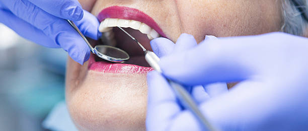 Best Emergency Dental Care for Broken or Chipped Teeth in Hillview, KY